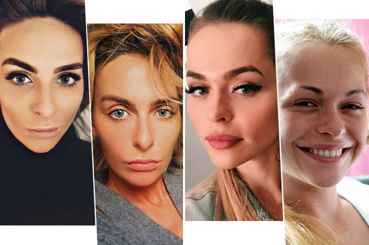 Почувствуй разницу: как выглядят российские звезды без макияжа
