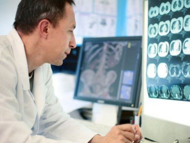 Компьютерная томография способна вызывать рак мозга